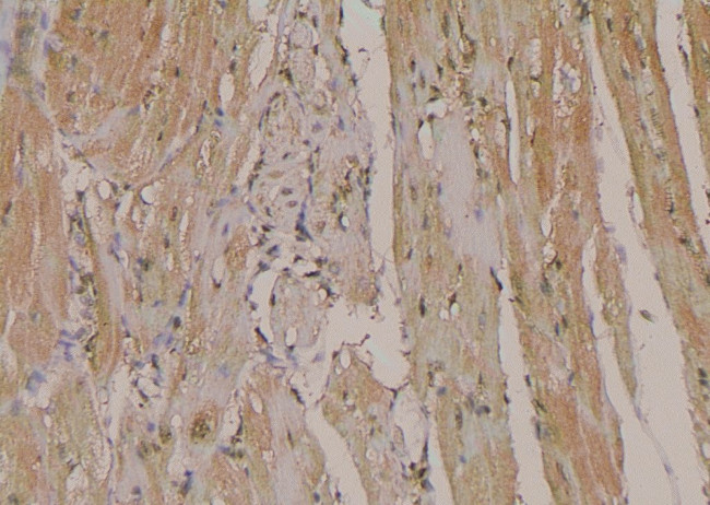 Phospho-NPM1 (Ser10) Antibody in Immunohistochemistry (Paraffin) (IHC (P))