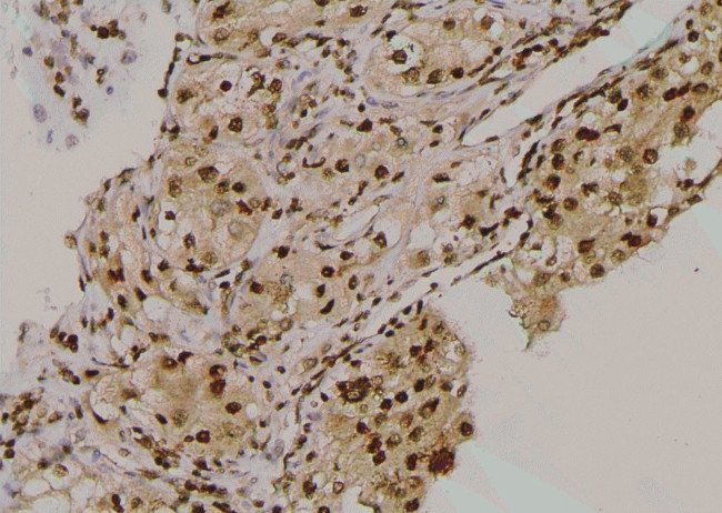 Phospho-beta-2 Adrenergic Receptor (Thr68) Antibody in Immunohistochemistry (Paraffin) (IHC (P))