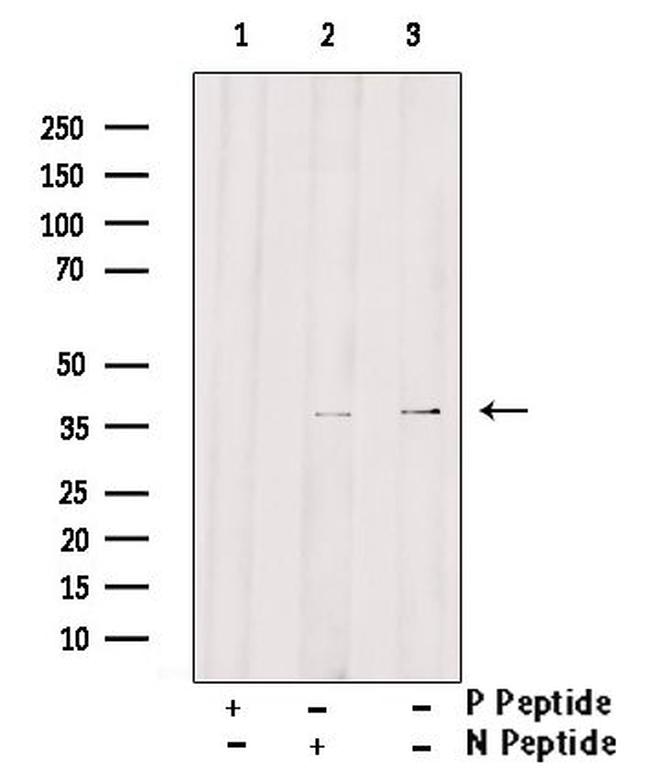 Phospho-beta-2 Adrenergic Receptor (Thr68) Antibody in Western Blot (WB)
