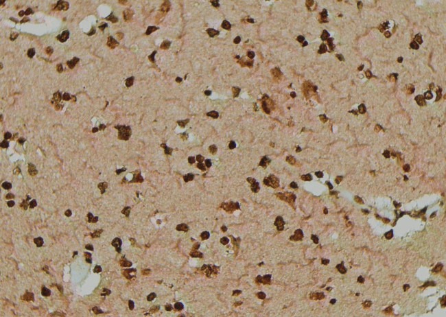 Phospho-EPRS (Tyr377) Antibody in Immunohistochemistry (Paraffin) (IHC (P))