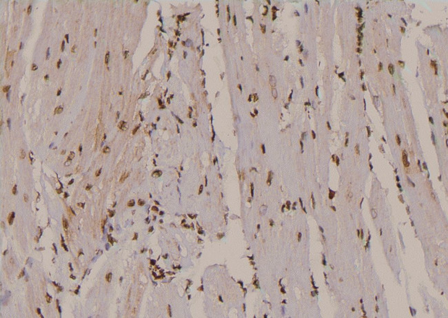 Phospho-EPRS (Tyr377) Antibody in Immunohistochemistry (Paraffin) (IHC (P))