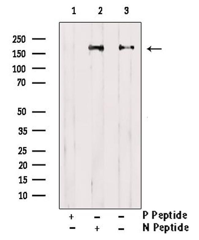 Phospho-EPRS (Tyr377) Antibody in Western Blot (WB)