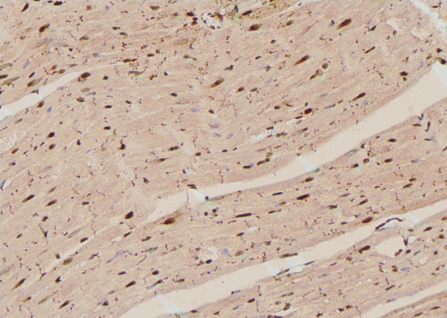 Phospho-Lyn (Tyr193) Antibody in Immunohistochemistry (Paraffin) (IHC (P))