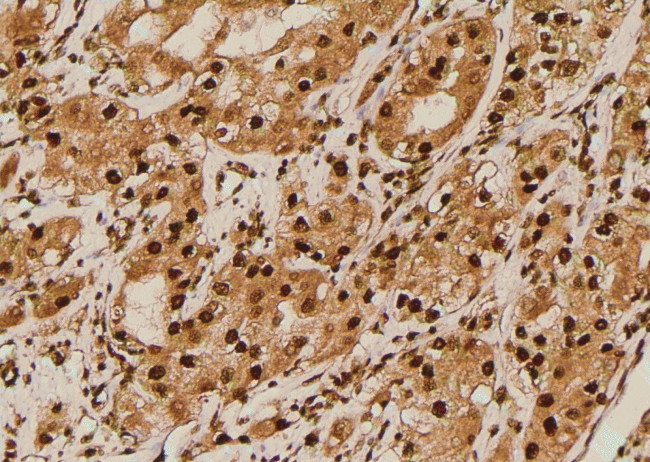 Phospho-IGF1R alpha (Thr1163) Antibody in Immunohistochemistry (Paraffin) (IHC (P))