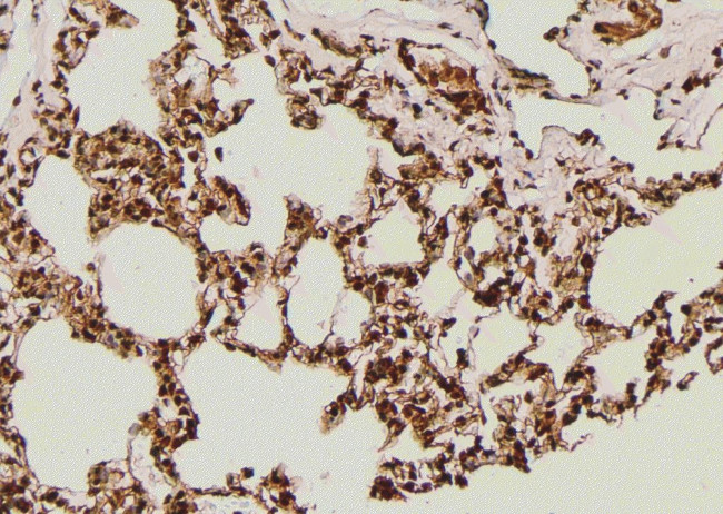 Phospho-IGF1R alpha (Thr1163) Antibody in Immunohistochemistry (Paraffin) (IHC (P))