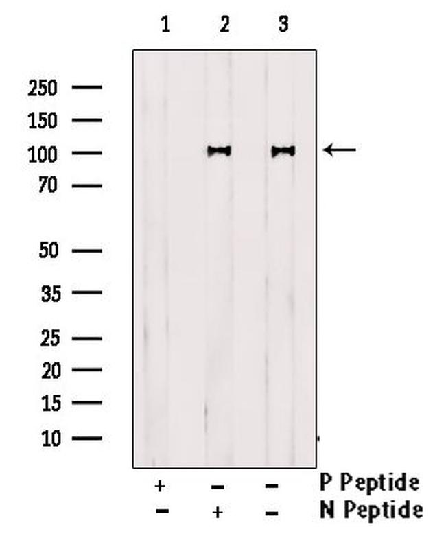 Phospho-IGF1R alpha (Thr1163) Antibody in Western Blot (WB)