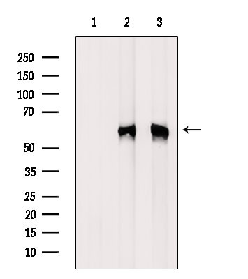 Phospho-HCK (Tyr522) Antibody in Western Blot (WB)