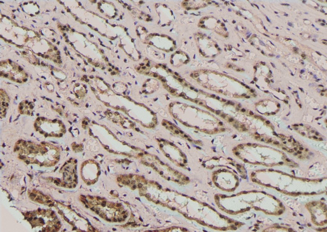 Phospho-CFTR (Thr1471) Antibody in Immunohistochemistry (Paraffin) (IHC (P))