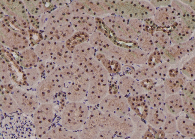 Phospho-CFTR (Thr1471) Antibody in Immunohistochemistry (Paraffin) (IHC (P))