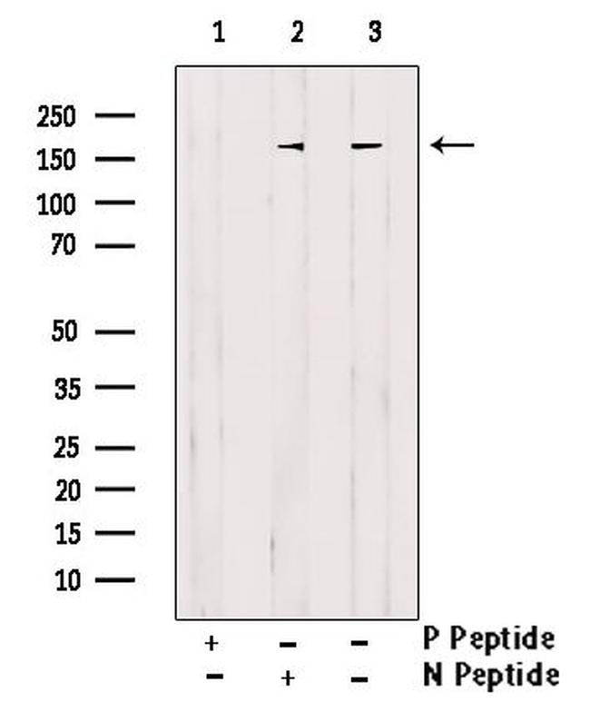 Phospho-CFTR (Thr1471) Antibody in Western Blot (WB)