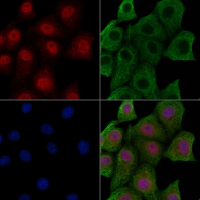 Phospho-EEF2 (Tyr443) Antibody in Immunocytochemistry (ICC/IF)