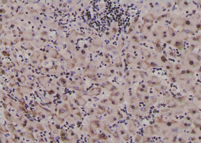 Phospho-GYS1 (Tyr44) Antibody in Immunohistochemistry (Paraffin) (IHC (P))