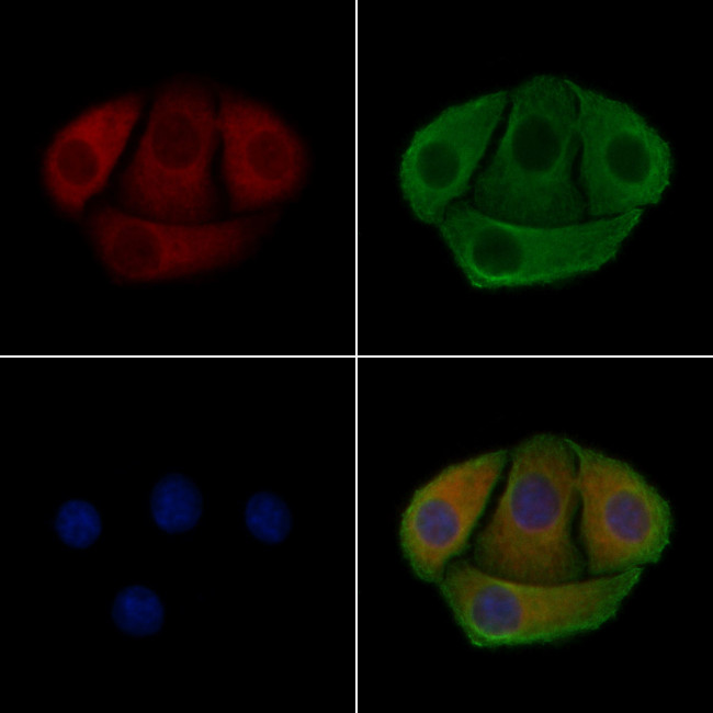 Phospho-p47phox (Ser304) Antibody in Immunocytochemistry (ICC/IF)