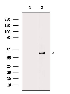 Phospho-p47phox (Ser304) Antibody in Western Blot (WB)