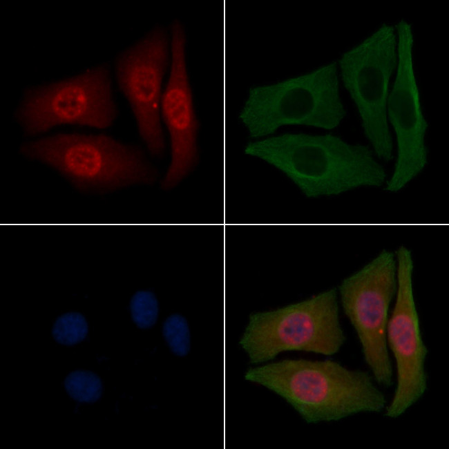 Phospho-BRAF (Ser729) Antibody in Immunocytochemistry (ICC/IF)