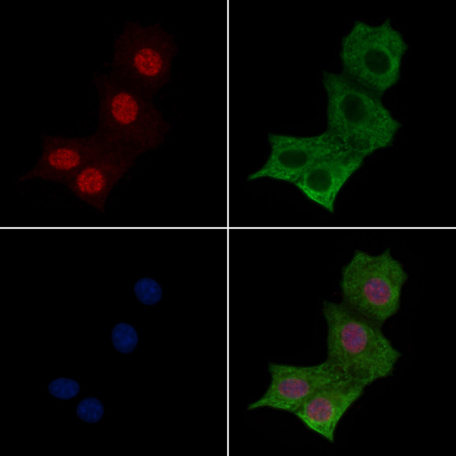 Phospho-MYOD (Thr115) Antibody in Immunocytochemistry (ICC/IF)