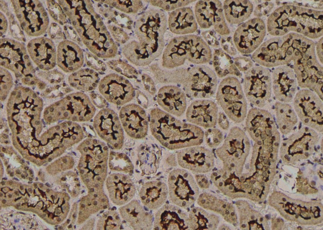 Phospho-MYOD (Thr115) Antibody in Immunohistochemistry (Paraffin) (IHC (P))