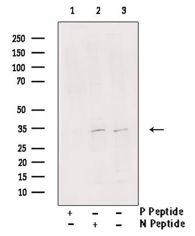 Phospho-MYOD (Thr115) Antibody in Western Blot (WB)