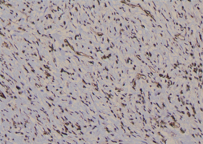 Phospho-IFNGR1 (Tyr457) Antibody in Immunohistochemistry (Paraffin) (IHC (P))