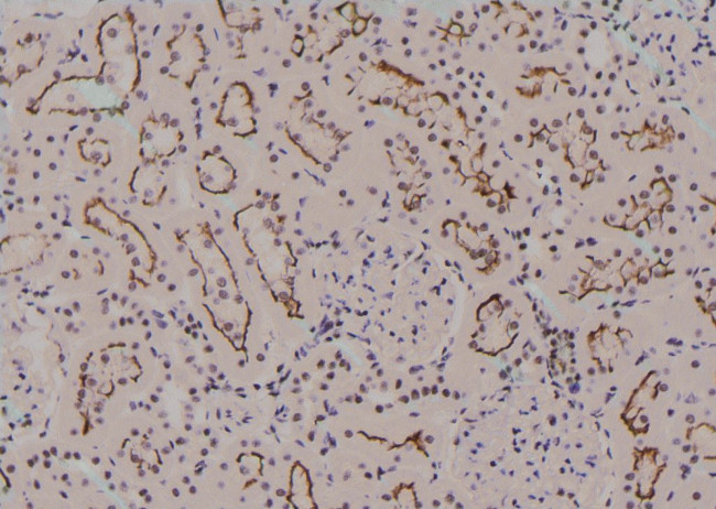 Phospho-IFNGR1 (Tyr457) Antibody in Immunohistochemistry (Paraffin) (IHC (P))