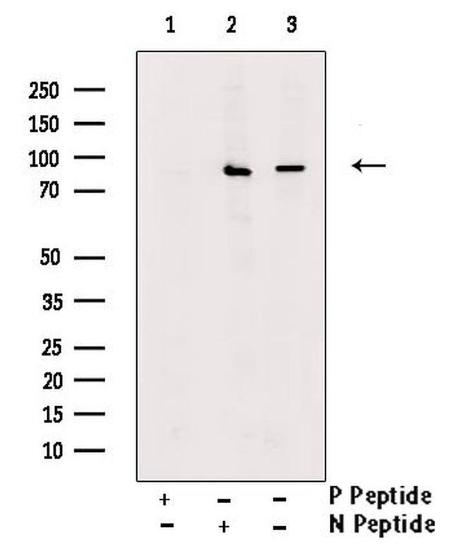 Phospho-IFNGR1 (Tyr457) Antibody in Western Blot (WB)