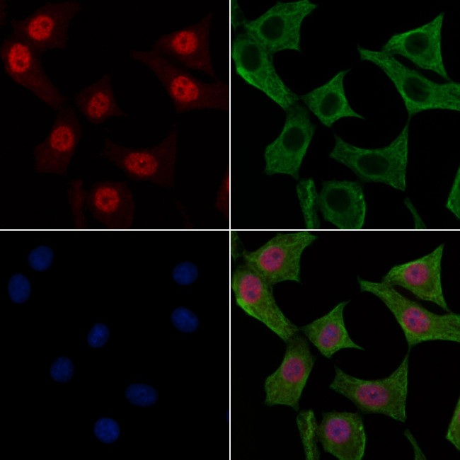 Phospho-FER (Tyr497) Antibody in Immunocytochemistry (ICC/IF)