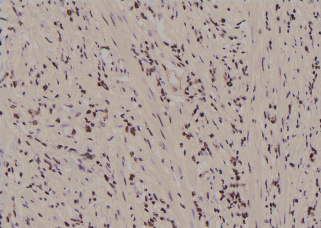 Phospho-FER (Tyr497) Antibody in Immunohistochemistry (Paraffin) (IHC (P))