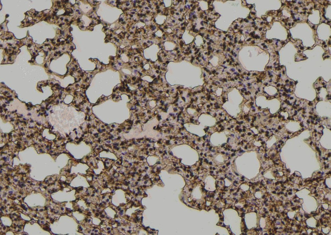 Phospho-FER (Tyr497) Antibody in Immunohistochemistry (Paraffin) (IHC (P))