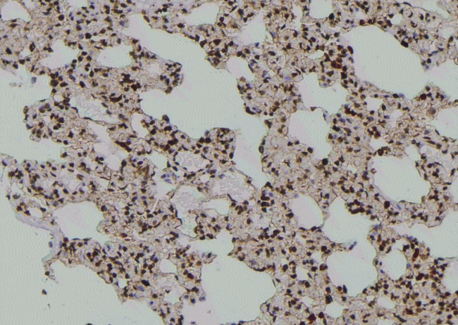 Phospho-FER (Tyr497) Antibody in Immunohistochemistry (Paraffin) (IHC (P))