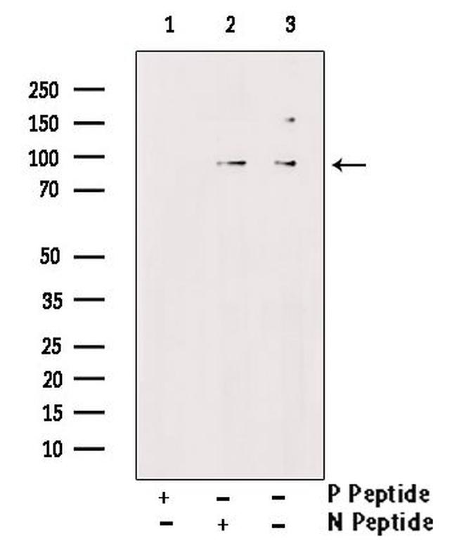 Phospho-FER (Tyr497) Antibody in Western Blot (WB)