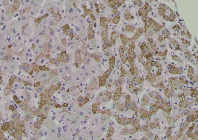 Phospho-PKC alpha (Tyr365) Antibody in Immunohistochemistry (Paraffin) (IHC (P))