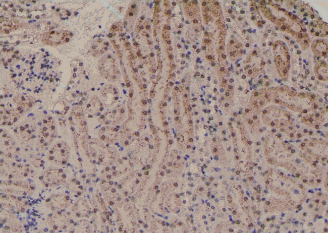 Phospho-PKC alpha (Tyr365) Antibody in Immunohistochemistry (Paraffin) (IHC (P))