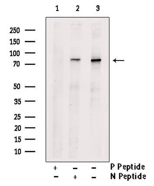 Phospho-PKC alpha (Tyr365) Antibody in Western Blot (WB)