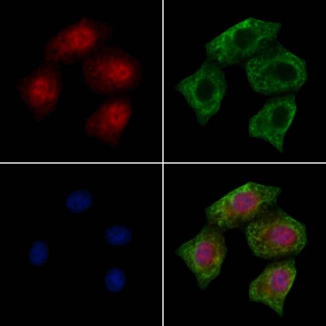 Phospho-PKC alpha (Tyr195) Antibody in Immunocytochemistry (ICC/IF)