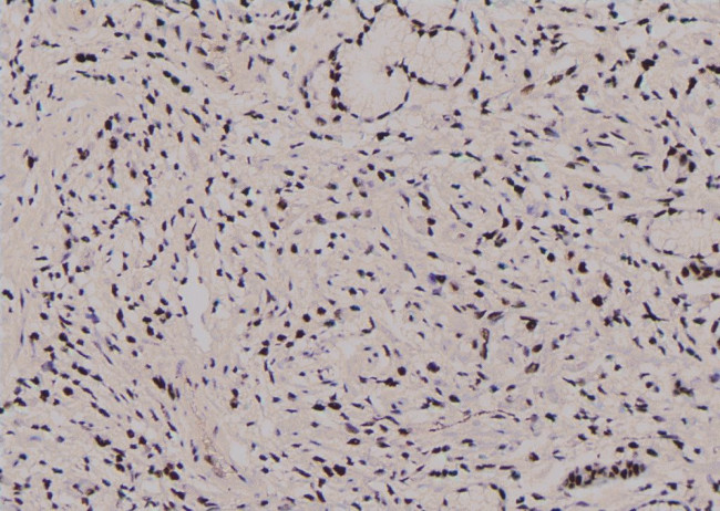 Phospho-JunB (Thr255) Antibody in Immunohistochemistry (Paraffin) (IHC (P))