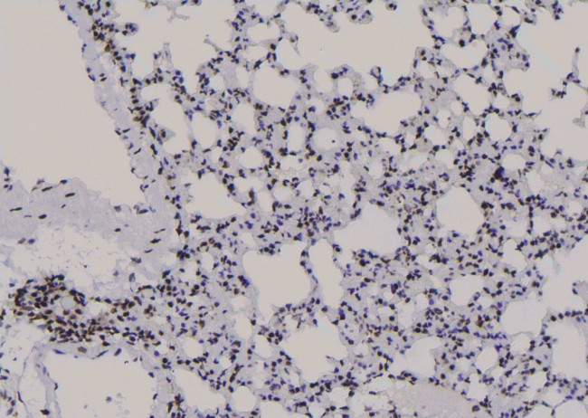 Phospho-JunB (Thr255) Antibody in Immunohistochemistry (Paraffin) (IHC (P))