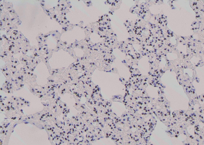 Phospho-JunB (Thr255) Antibody in Immunohistochemistry (Paraffin) (IHC (P))