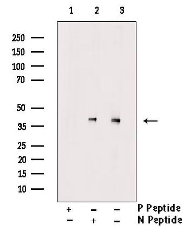 Phospho-JunB (Thr255) Antibody in Western Blot (WB)