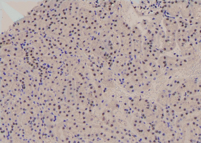 Phospho-JunB (Ser259) Antibody in Immunohistochemistry (Paraffin) (IHC (P))