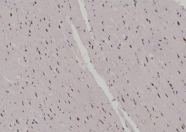 Phospho-JunB (Ser259) Antibody in Immunohistochemistry (Paraffin) (IHC (P))