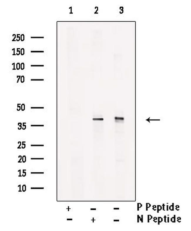 Phospho-JunB (Ser259) Antibody in Western Blot (WB)