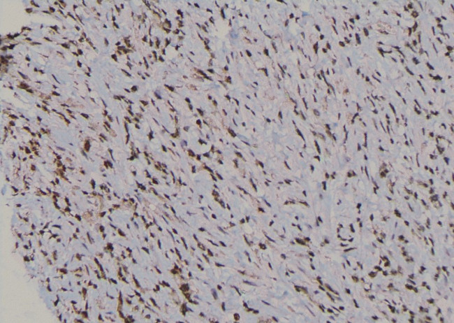 Phospho-UBF-1 (Thr117) Antibody in Immunohistochemistry (Paraffin) (IHC (P))