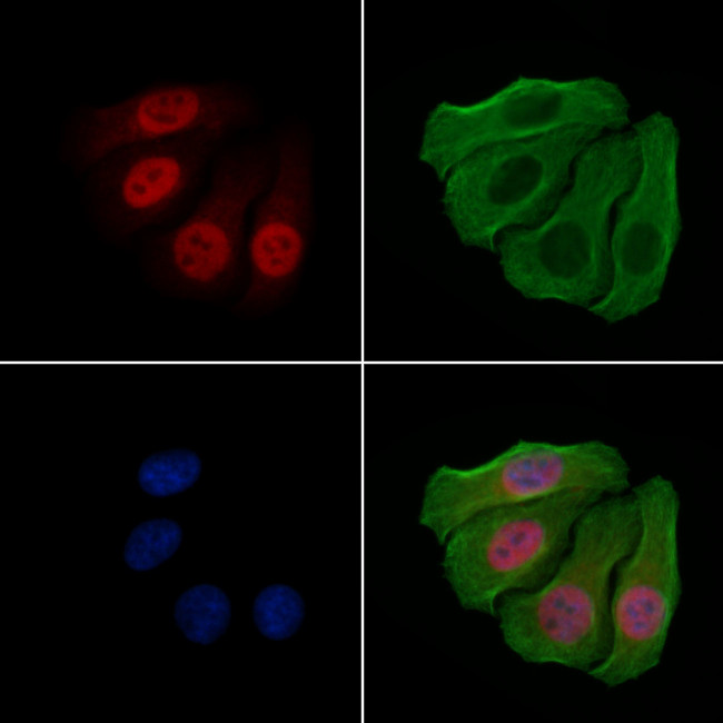 Phospho-JunD (Ser259) Antibody in Immunocytochemistry (ICC/IF)