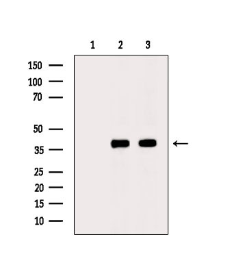 Phospho-PKA alpha/beta/gamma (Thr198) Antibody in Western Blot (WB)