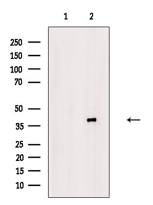 Phospho-PKA alpha/beta/gamma (Thr198) Antibody in Western Blot (WB)