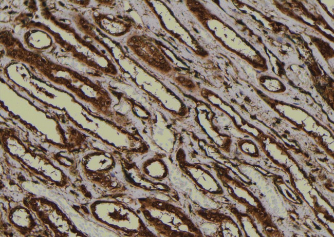 Phospho-PKA alpha/beta/gamma (Thr198) Antibody in Immunohistochemistry (Paraffin) (IHC (P))