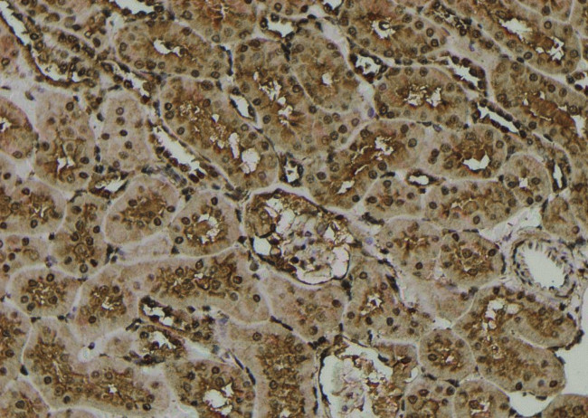 Phospho-PKA alpha/beta/gamma (Thr198) Antibody in Immunohistochemistry (Paraffin) (IHC (P))