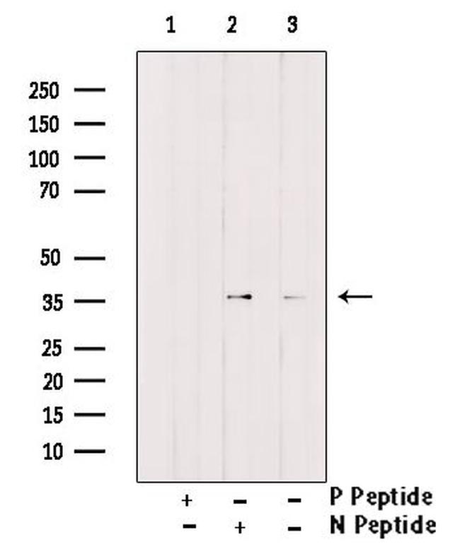 Phospho-C/EBP beta (Ser76) Antibody in Western Blot (WB)