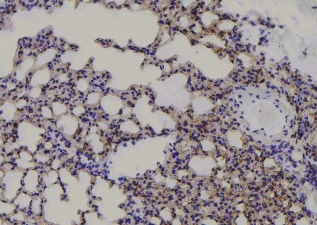 Phospho-VEGF Receptor 1 (Tyr1048) Antibody in Immunohistochemistry (Paraffin) (IHC (P))