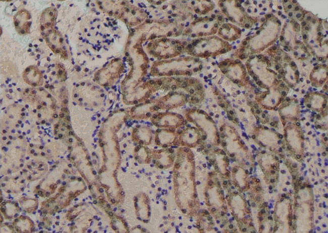 Phospho-VEGF Receptor 1 (Tyr1048) Antibody in Immunohistochemistry (Paraffin) (IHC (P))